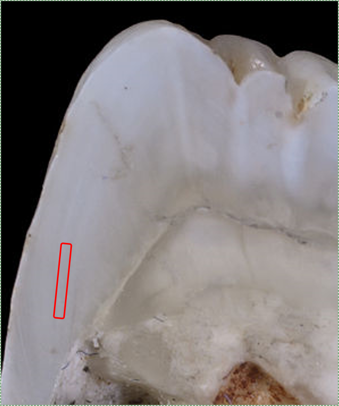 photo of a tooth in cross section